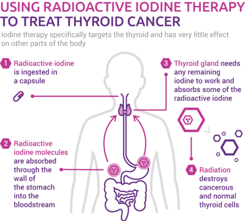 Thyroid Cancer Treatments Professor Christopher Nutting Oncology